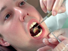 Лечение кариеса зубов в пензе thumbnail