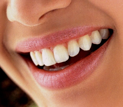 Можно ли отбеливать депульпированный зуб?