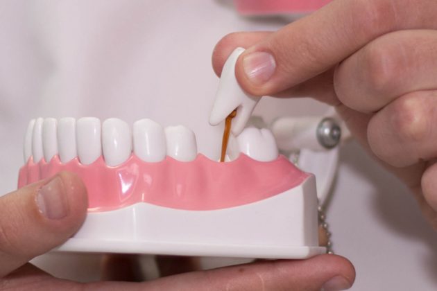 Что делать, если сломался зубной протез?