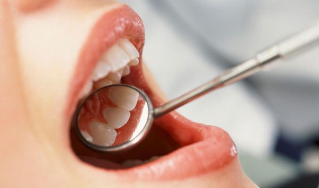 Лечение кисты зуба в Пензе