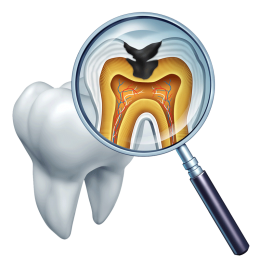Лечение пульпита в Пензе в стоматологии «Юдент»