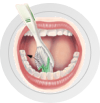 Классическая имплантация зубов в Пензе без боли с пожизненной гарантией