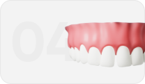 Виниры на зубы под ключ в Пензе от 24 350 ₽/зуб